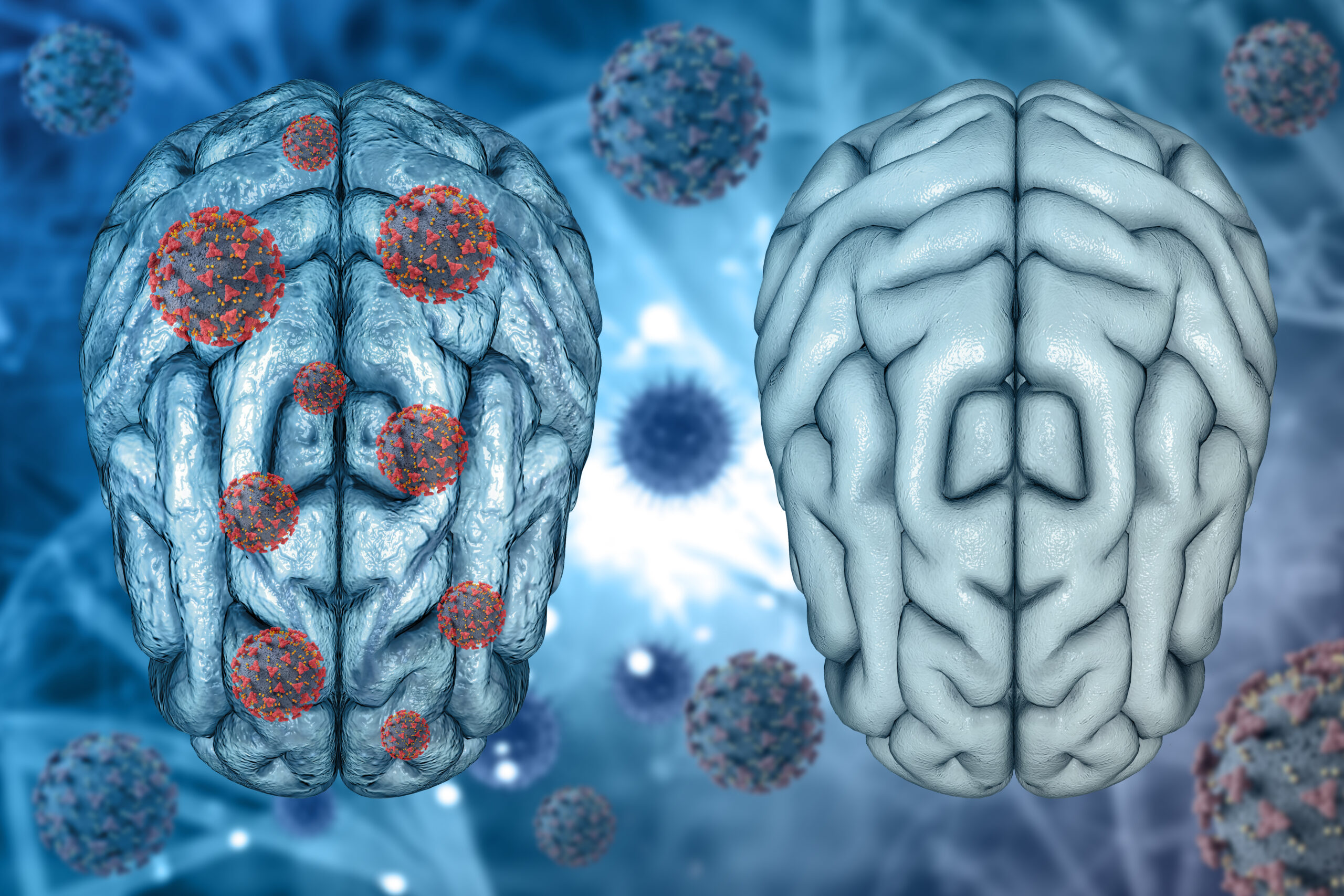 3d render medical background healthy brain diseased brain with covid 19 virus cells scaled