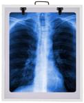 Fidelis X'ray View Box 14inch x 17inch White Single
