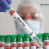 Birdflu testing