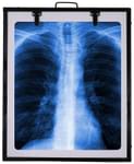 Fidelis X'ray View Box 14inch x 17inch Black Single
