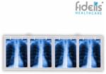 Fidelis X'ray View Box 18inch x 56inch White Four
