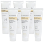 Acnedew PH Balanced Anti Acne & Anti Pimple Cream (25gm Each)