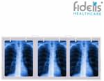 Fidelis X'ray View Box 18inch x 42inch White Triple