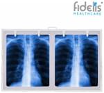 Fidelis X'ray View Box 18inch x 28inch White Double