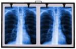 Fidelis X'ray View Box 18inch x 28inch Black Double