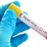 Nipah Virus